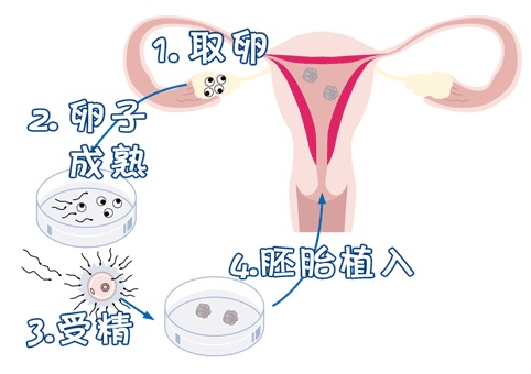 光愈生殖医学中心环境